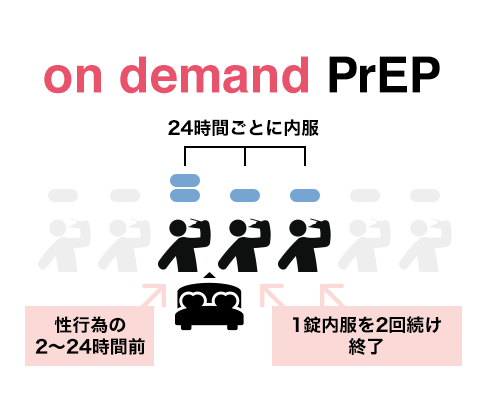on demand PrEP（2-1-1）